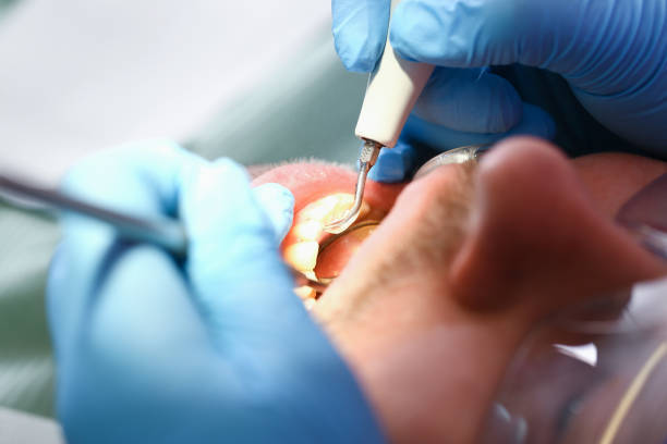 Best Pediatric Emergency Dentist in Eastmont, WA
