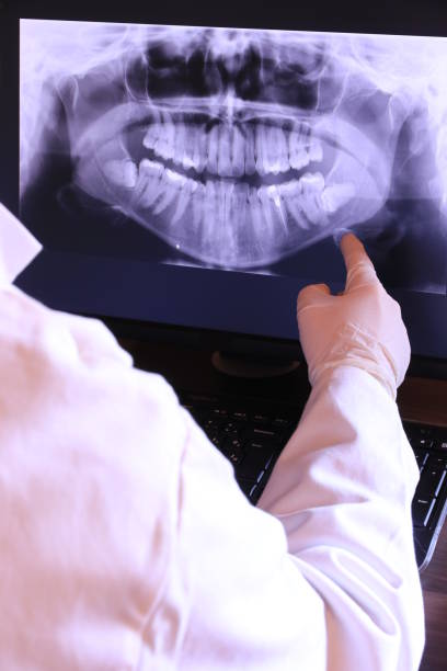Best Broken or Cracked Tooth Emergency Dentist in Eastmont, WA