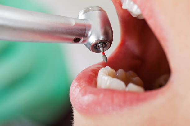 Best Emergency Dentist for Knocked-Out Tooth in Eastmont, WA